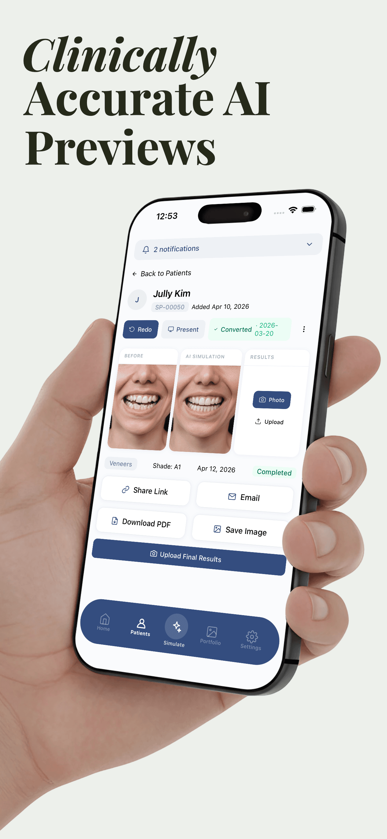 Before and after AI smile preview in the Smile PreVue app